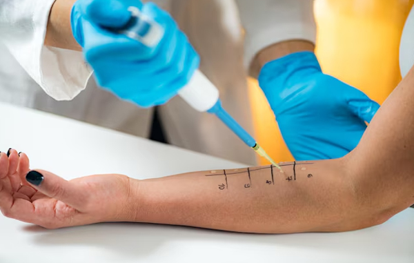Allergy and Immunotherapy