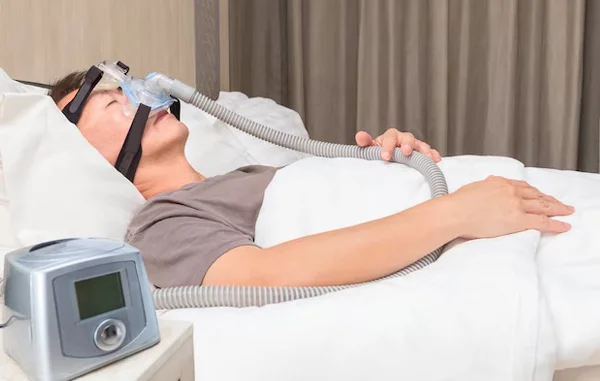 Sleep Apnea and Management
